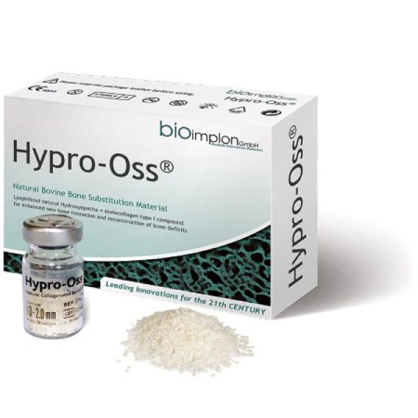 Bovine Bone Graft Bovine Bone Graft