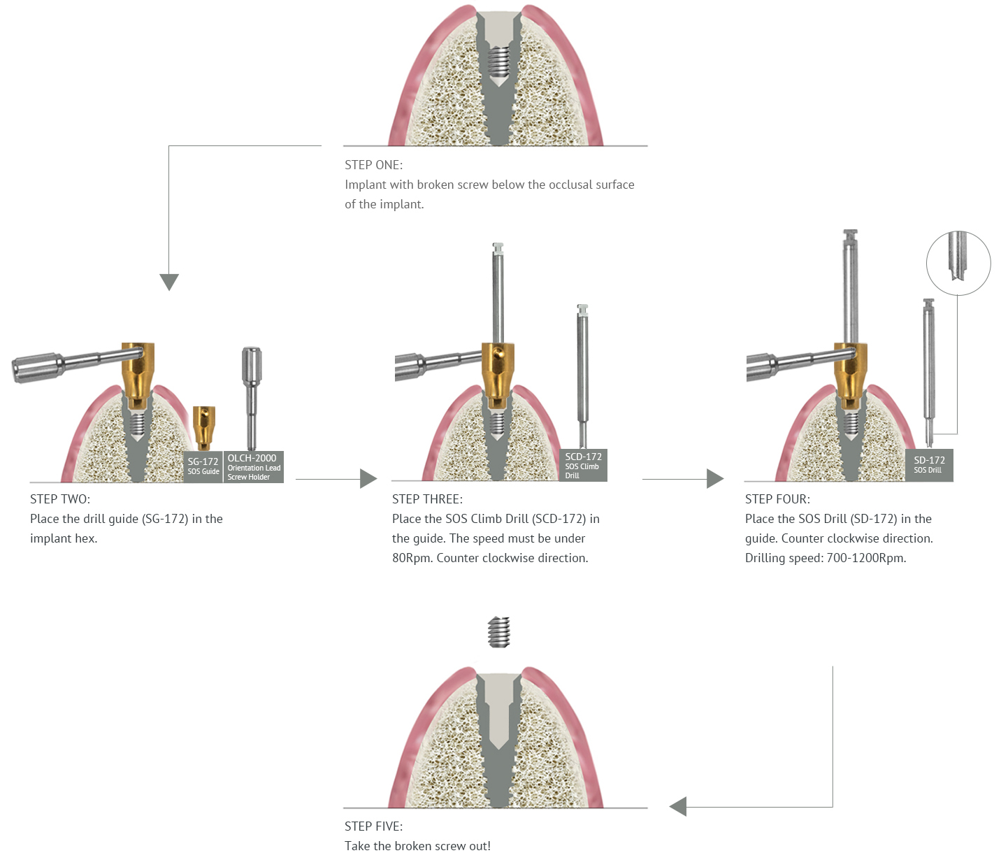 Screw removal kit Dental Implants